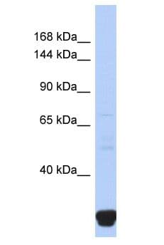 ITPR2 / IP3 Receptor Type 2 Antibody (aa53-102)