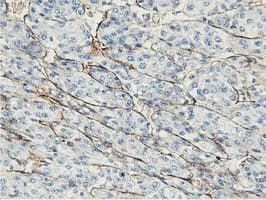 Adiponectin Antibody (aa19-244, clone OTI1B2, Carrier-free)
