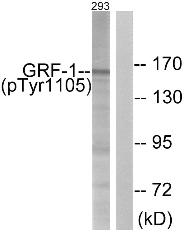 ARHGAP35 / GRLF1 Antibody (phospho-Tyr1105)
