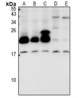 Polyclonal Rabbit anti-Human CYB5B Antibody (WB)