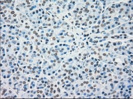 Monoclonal Mouse anti-Human MAP2K4 / MKK4 Antibody (clone OTI8A8, IHC, IF, WB)