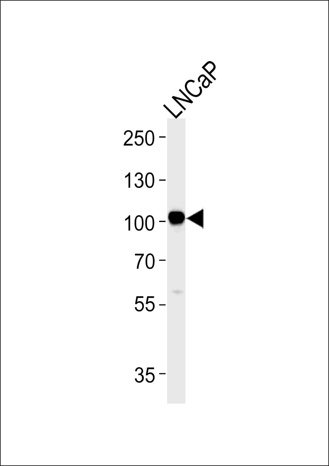 MME / CD10 Antibody (aa721-747)