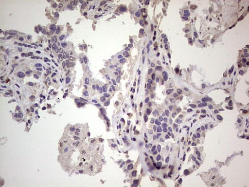 Monoclonal Mouse anti-Human RET Antibody (clone OTI4H3, aa713-1017, IHC, WB)