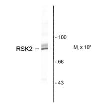 IHC-plus™ Polyclonal Rabbit anti-Mouse RPS6KA3 / RSK2 Antibody (C-Terminus, IHC, WB)