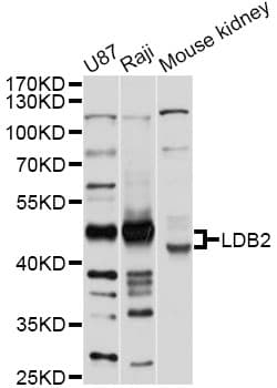Polyclonal Rabbit anti-Human LDB2 Antibody (WB)