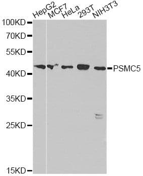 Polyclonal Rabbit anti-Human PSMC5 / SUG1 Antibody (IHC, WB)