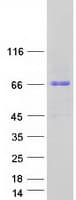 Human KBTBD8 Protein (Recombinant Myc-DDK (Flag))