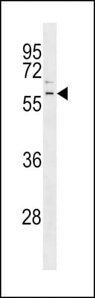 PARK2 / Parkin 2 Antibody (aa387-417)