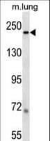 LAMB1 / Laminin Beta 1 Antibody (aa1691-1720)