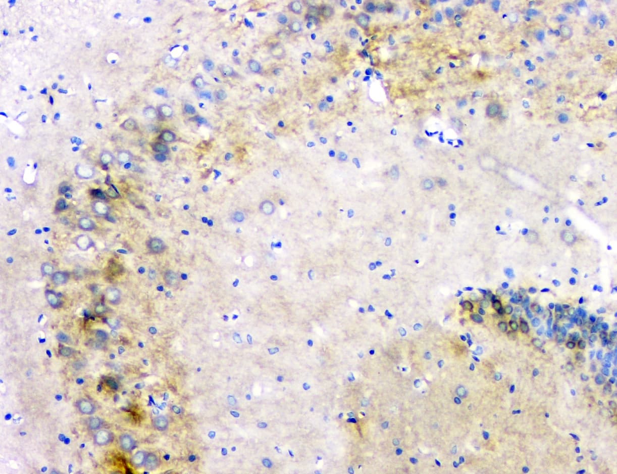 APP / Beta Amyloid Precursor Antibody (aa672-713)
