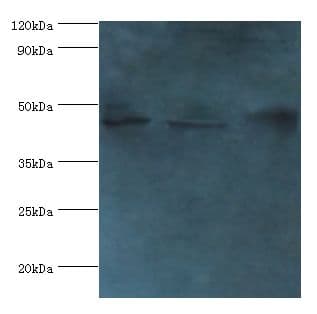SERPINB2 / PAI-2 Antibody (aa1-416)
