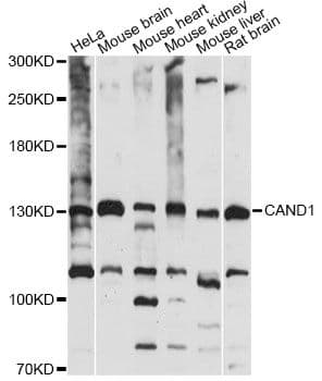 Polyclonal Rabbit anti-Human TIP120 / CAND1 Antibody (WB)