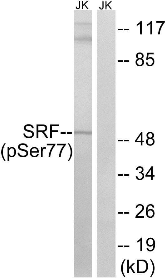 SRF / Serum Response Factor Antibody (phospho-Ser77)
