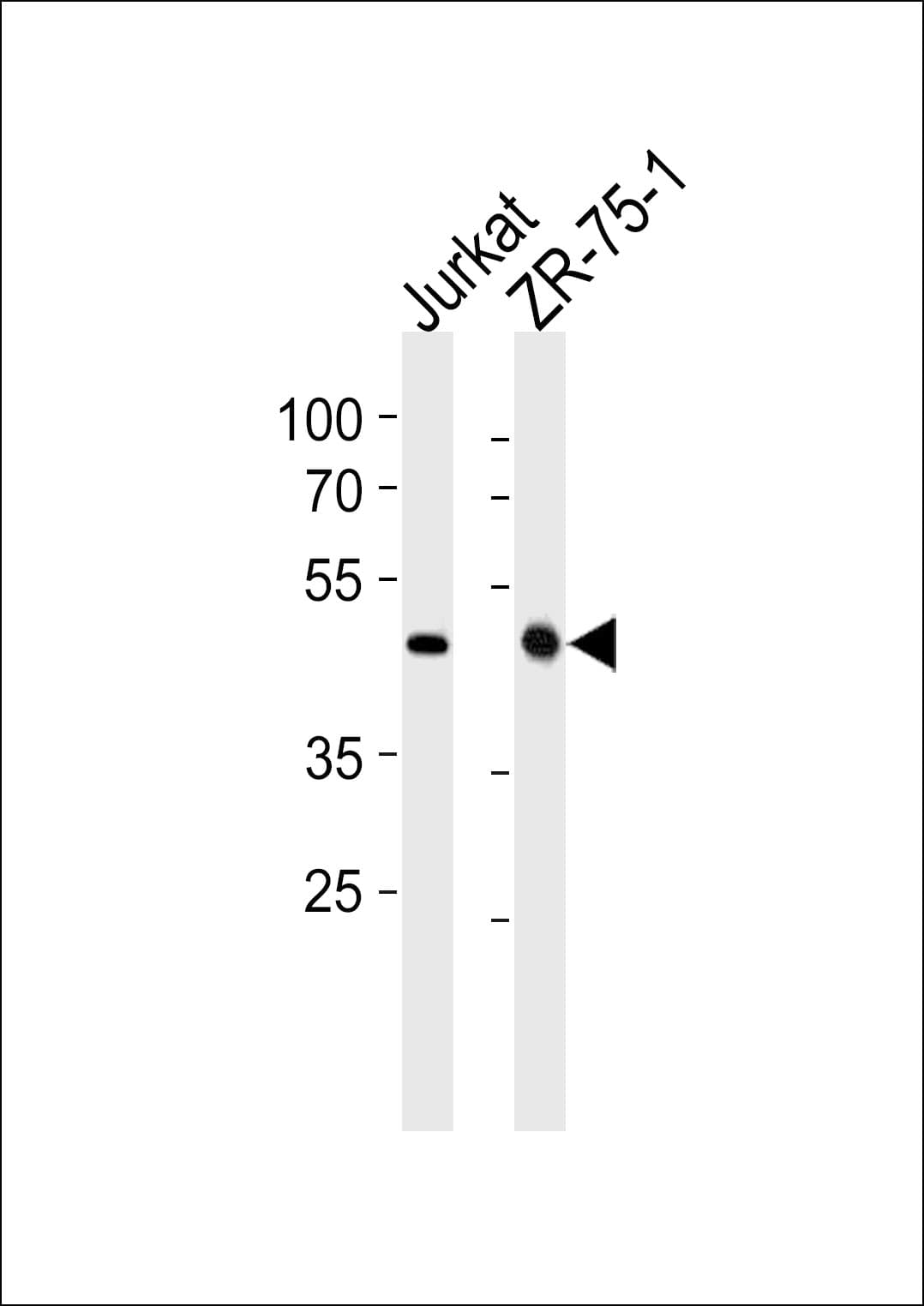 Polyclonal Rabbit anti-Human ECSIT Antibody (aa396-425, IF, WB)