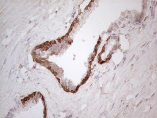 Monoclonal Mouse anti-Human ASPA Antibody (clone OTI3G5, aa77-313, IHC, WB)