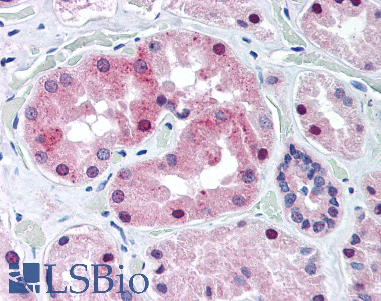 IHC-plus™ Polyclonal Rabbit anti-Human KCNE3 Antibody (Internal, IHC)