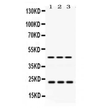 Polyclonal Rabbit anti-Human RAB13 Antibody (aa121-150, IHC, WB)