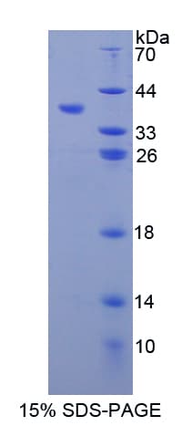 Mouse MMP10 Protein (Recombinant His-T7)