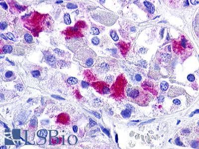 PathPlus™ GnRH receptor / GNRHR Antibody (Cytoplasmic Domain)