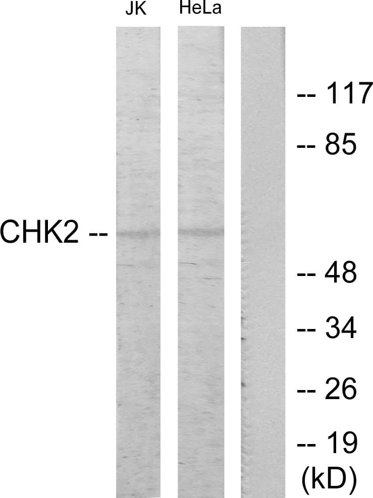 IHC-plus™ Polyclonal Rabbit anti-Human CHEK2 / CHK2 Antibody (aa35-84, IHC, WB)