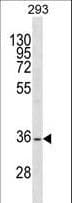 Polyclonal Rabbit anti-Human SSBP2 Antibody (aa1-30, WB)
