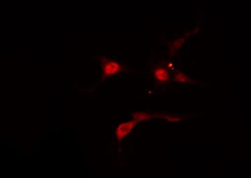 RAD51 / RECA Antibody