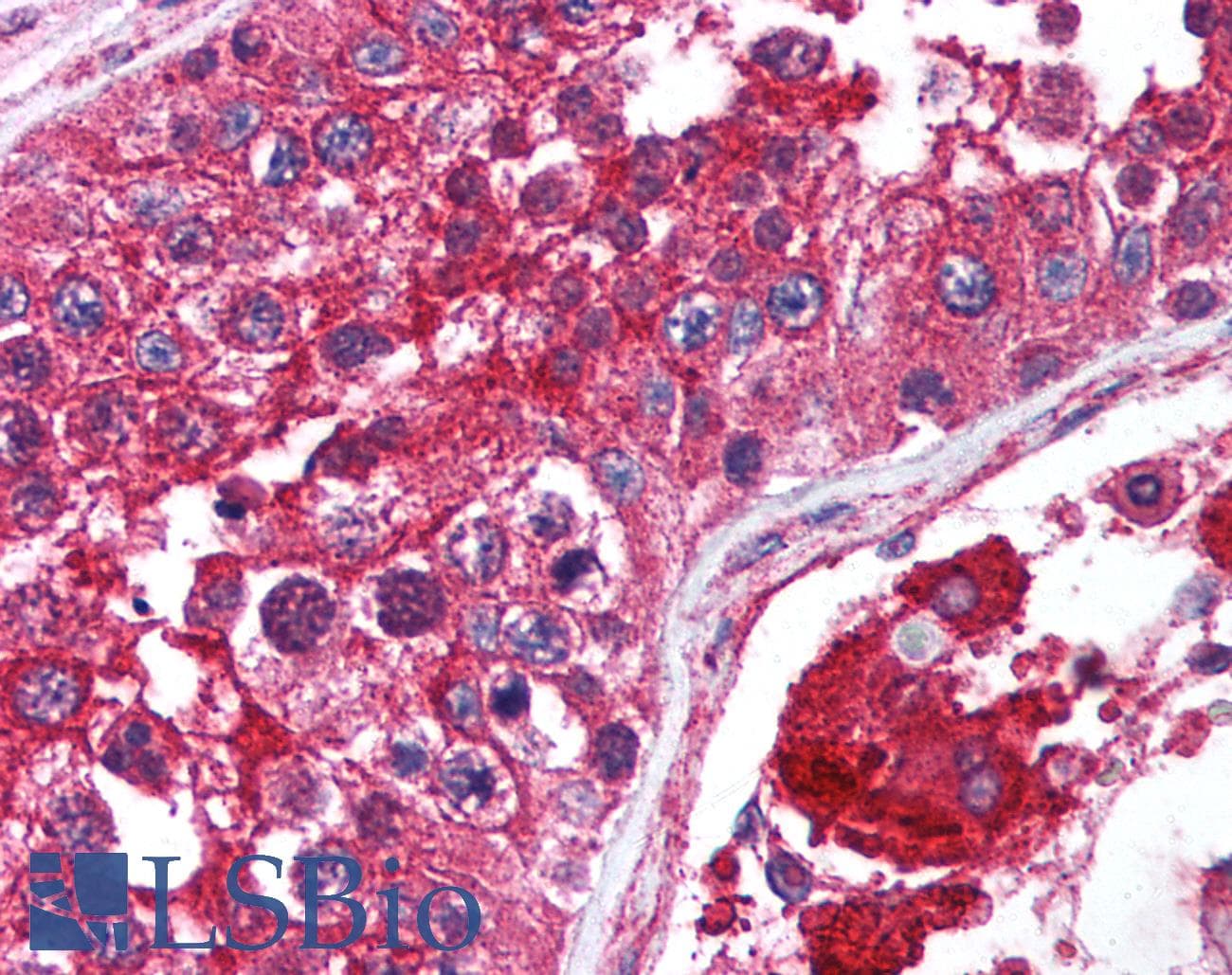 PathPlus™ MTOR Antibody