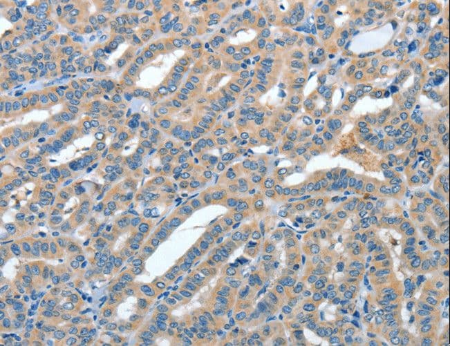 ANGPT1 / Angiopoietin-1 Antibody