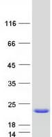 Human ARF1 Protein (Recombinant Myc-DDK (Flag))