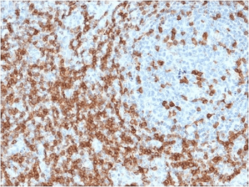CD5 Antibody (clone CD5/2419, Azide-free, BSA-free)