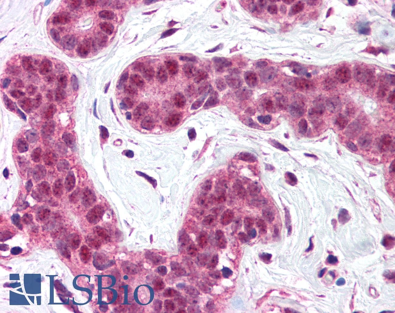 IHC-plus™ BCL10 / BCL-10 Antibody