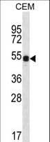 DAZ3 Antibody (aa445-474)