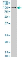 IHC-plus™ Monoclonal Mouse anti-Human POLK / DNA Polymerase Kappa Antibody (clone 6F2, IHC, IF, WB)
