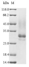 Synsepalum dulcificum Miraculin Protein (Recombinant 10His, N-terminus)