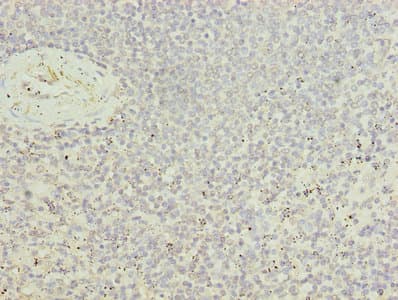 Polyclonal Rabbit anti-Human UBASH3B / STS-1 Antibody (IHC)