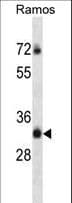 TMEM55B Antibody (aa183-211)