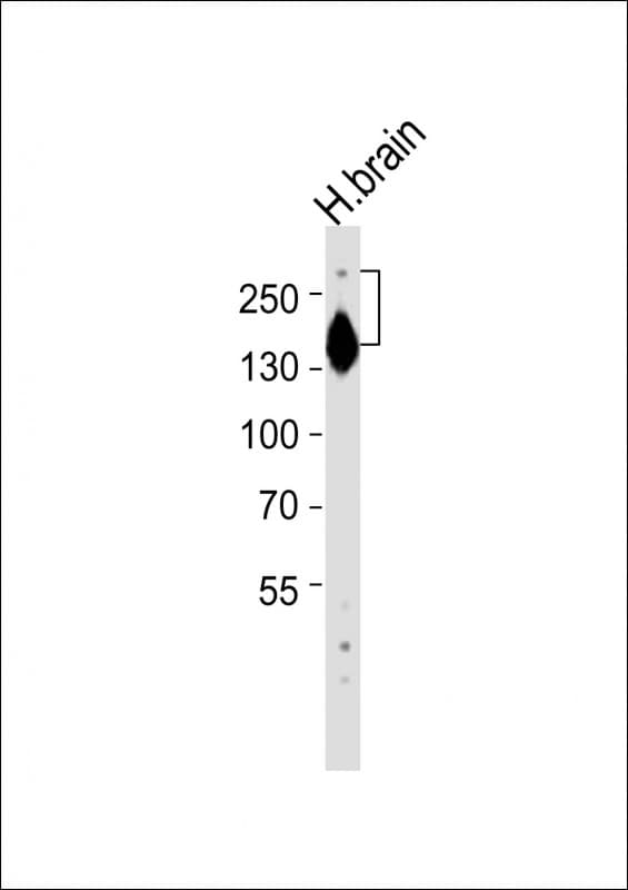 SPTAN1 / Alpha Fodrin Antibody (aa977-991)