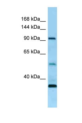 ROR1 Antibody (aa155-204)