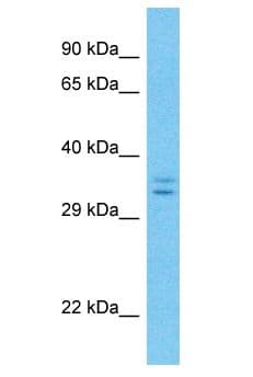 Polyclonal Rabbit anti-Human LRRC10B Antibody (aa216-265, WB)