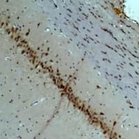 Polyclonal Rabbit anti-Human CACNA2D2 Antibody (IHC, WB)