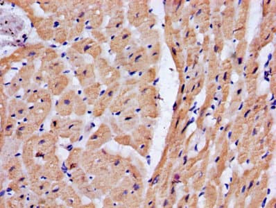 Polyclonal Rabbit anti-Human TNNT2 / CTNT Antibody (WB)