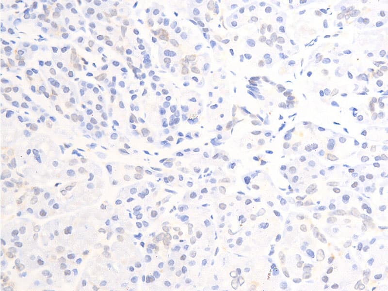 ERBB2 / HER2 Antibody (phospho-Tyr877)