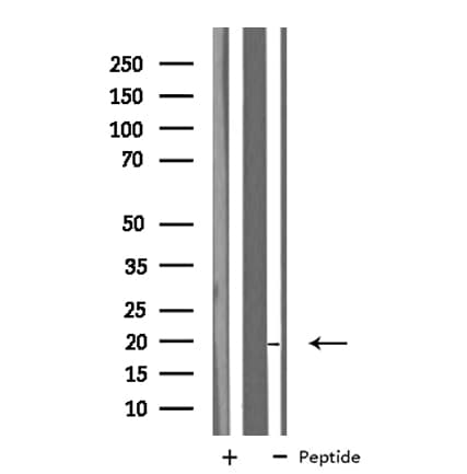 MB / Myoglobin Antibody