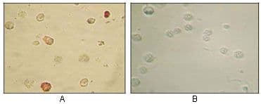 HHV-8 ORF45 Antibody (clone 2D4A5)