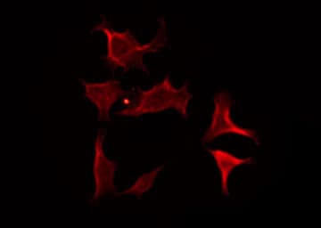 Polyclonal Rabbit anti-Human CACNA2D4 Antibody (IF, WB)