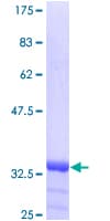 Human INVS / Inversin Protein (Recombinant GST)