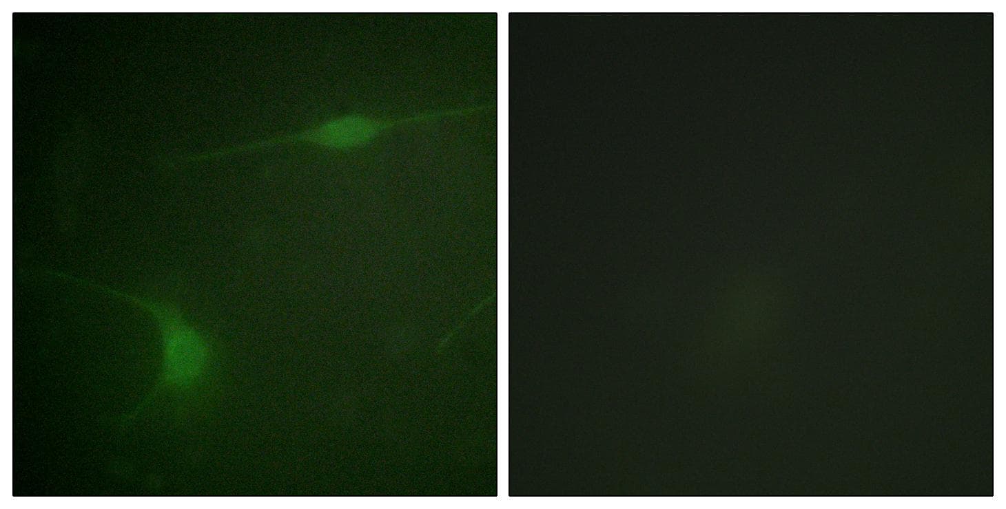 MAPK8IP1 / JIP1 Antibody (phospho-Thr103)