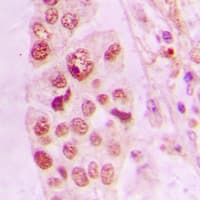 LIMK2 Antibody (Internal)
