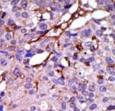 CASK Antibody (aa564-596)