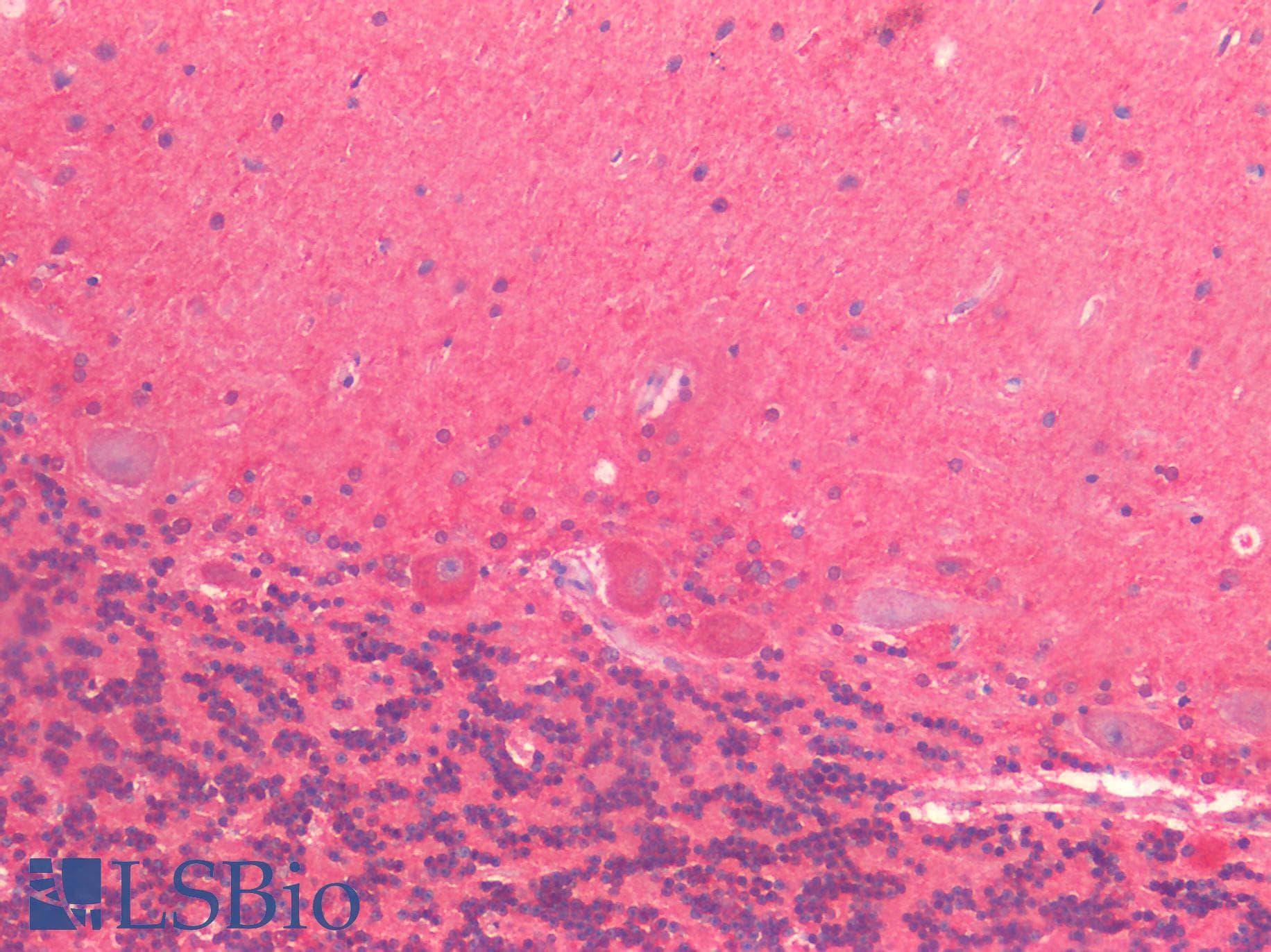 PathPlus™ CRBN / Cereblon Antibody